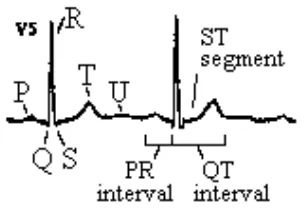 Gambar 2-3 Grafik Denyut Jantung Normal 