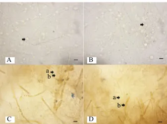 Gambar 8. Mekanisme hambatan Talaromyces sp. terhadap  Fusarium oxysporum menghasilkan banyak  klamidospora Fusarium oxysporum (A-B)