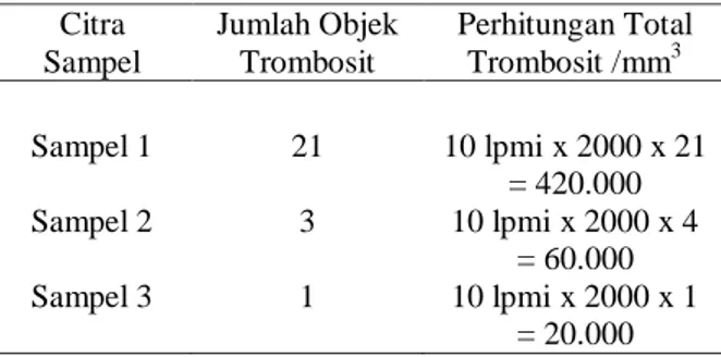 Tabel 6. Perbandingan Hasil Perhitungan Total  Trombosit  Citra  Sampel  Jumlah Objek Trombosit  Perhitungan Total Trombosit /mm3 Sampel 1  21  10 lpmi x 2000 x 21  = 420.000  Sampel 2  3  10 lpmi x 2000 x 4  = 60.000  Sampel 3  1  10 lpmi x 2000 x 1  = 20