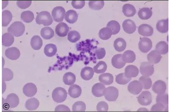 Gambar 3. Keping darah  Demam Berdarah 