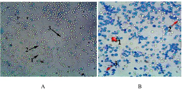 Gambar 10. Hasil Pengecatan Sederhana isolat S.cerevisiae dari PG-PS   Madukismo dan S.cerevisiae ATCC 3015   