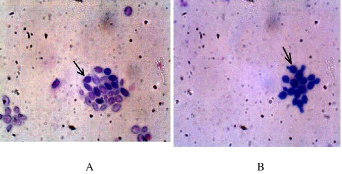Gambar 11. Hasil Pengecatan Gram isolat S.cerevisiae dari PG-PS Madukismo dan S. cerevisiae ATCC 3015 