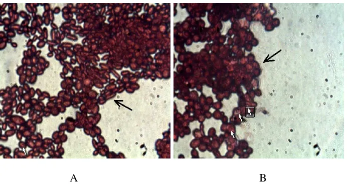 Gambar 12. Hasil Pengecatan Spora isolat S.cerevisiae dari PG-PS Madukismo dan S.cerevisiae ATCC 3015  