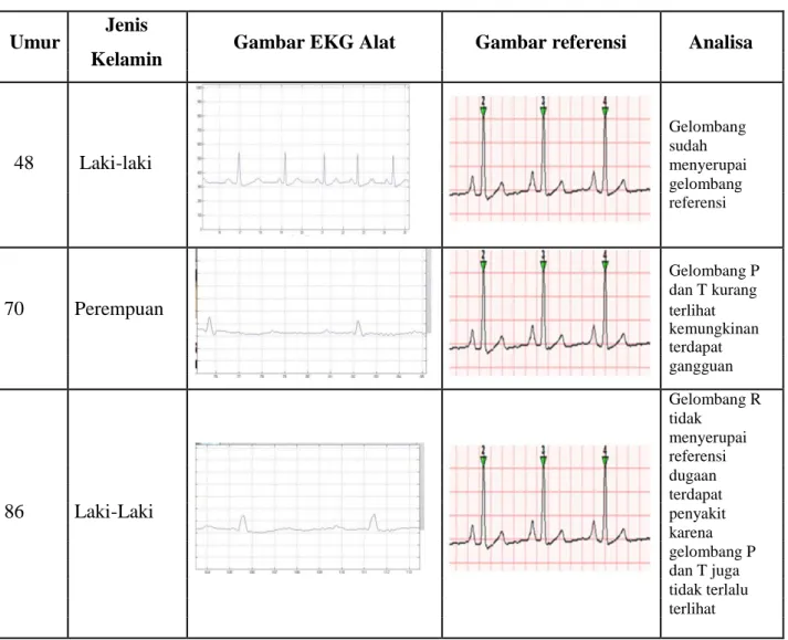 Tabel 2. Data EKG Beberapa Pasien Dengan Umur Yang Berbeda (lanjutan)  Umur  Jenis 