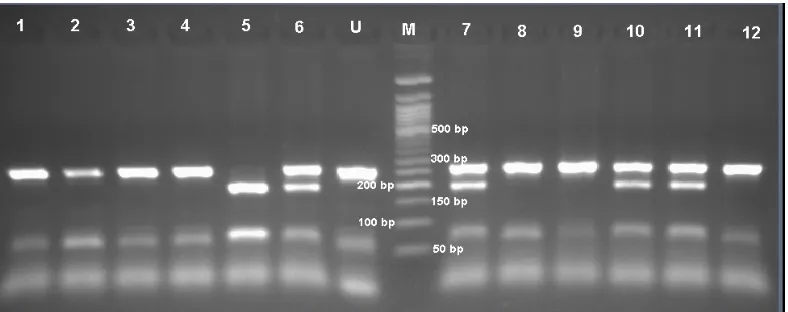 Figure 1. Genotyping of VDR FokI polymorphism by PCR-RFLP.       Lane 1,2,3,4,8,9, and 12: FF genotype; lane 5: 196 ff genotype;                               lane 6,7,10 and 1: Ff genotype  