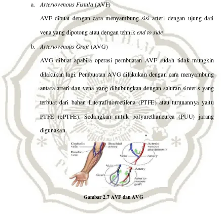 Gambar 2.7 AVF dan AVG 