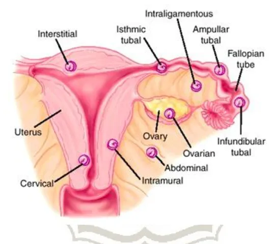 Gambar 2. 1 organ sistem reproduksi internal wanita  (Wiknjosastro, 