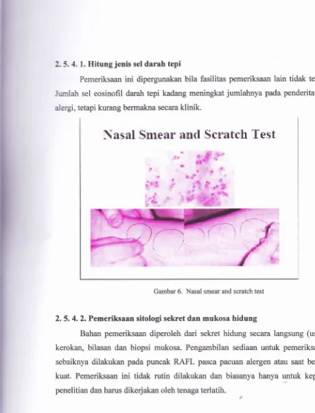 Gambar 6. Nasal smear and scratch test