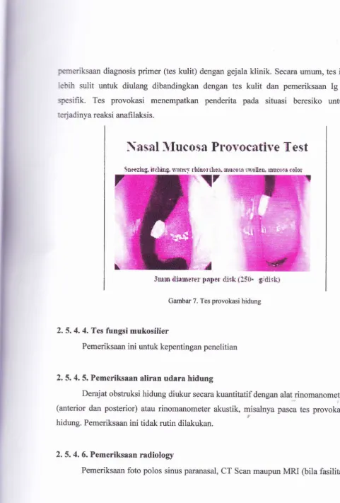 Gambar 7. Tes provokasi hidung