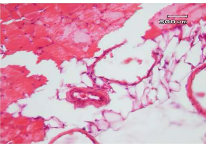 Gambar 1. Kelenjar endometrium pada dinding peritoneum mencit, disebut sebagai Endometriosis like lession 
