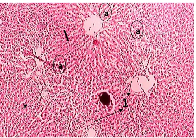 Gambar 9. Foto mikroskopi organ hati tikus jantan hemorrhage (a) dan degenerasi hidrofik (b) setelah pemberian air minum Aqua 25 ml/kgBB dengan pengecatan HE, perbesaran 400x