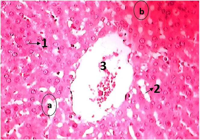 Gambar 11. Foto mhidrofik dengan sinusoid; (3Foto mikroskopi organ hati tikus jantan yang mengahidrofik (a) dan nekrosis (b) setelah pemberian jus wortdengan pengecatan HE, perbesaran 400x