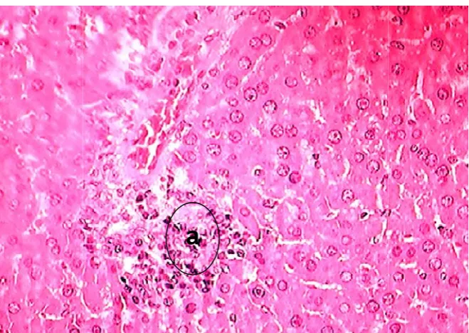 Gambar 12. Foto mikrosFoto mikroskopi organ hati tikus jantan yang mengalami (a) setelah (a) setelah pemberian jus wortel 1,094 g/kgBB dengan perbesaran 400x