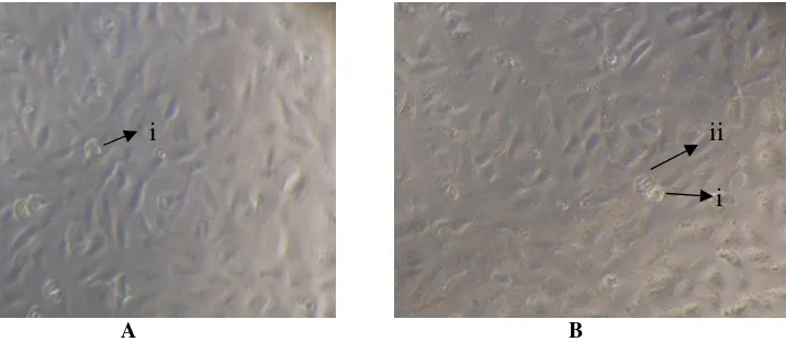 Gambar 1. Kultur sel HeLa di haemocytometer setelah diberi trypan blue Ket. : i = sel HeLahidup dan ii = sel HeLa mati
