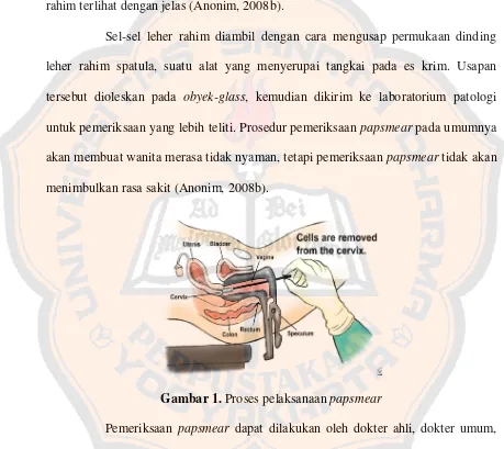 Gambar 1. Proses pelaksanaan papsmear 