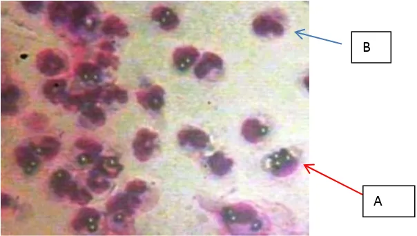 Gambar 1. Aktifitas fagositosis makrofag peritoneal tikus SD yang diinduksi DMBA atau tak diinduksi DMBA dengan pemberian EHBJH secara in vitro