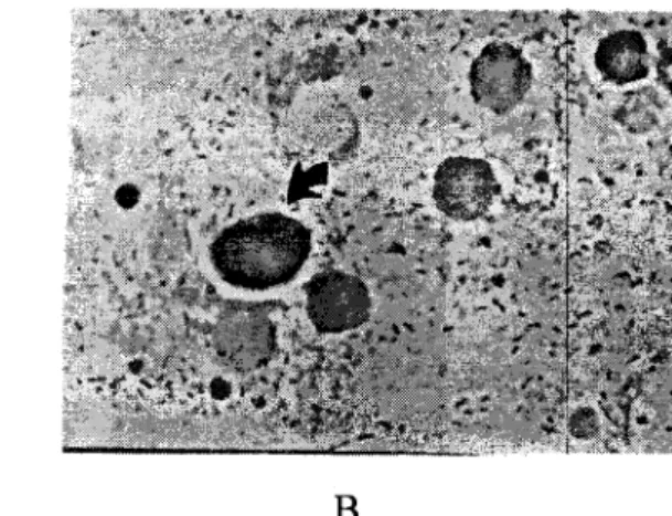 Gambar  2.  Hasil  uji  hambatan  perlekatan  bakteri  Salmonella  typhi  Isolat  RS&#34;  Kariadi