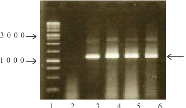 Gambar 1.   Elektroforesis gel agarose DNA patogen CVPD yang diamplifikasi dengan primer spesifik OI1  dan  OI2c dari tanaman jeruk terinfeksi CVPD di kabupaten Jeneponto