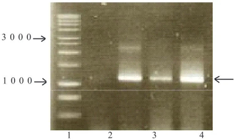 Gambar 3.   Elektroforesis gel agarose DNA patogen CVPD yang diamplifikasi dengan primer spesifik OI1  dan  OI2c dari tanaman jeruk terinfeksi CVPD di Serdang (Malaysia)