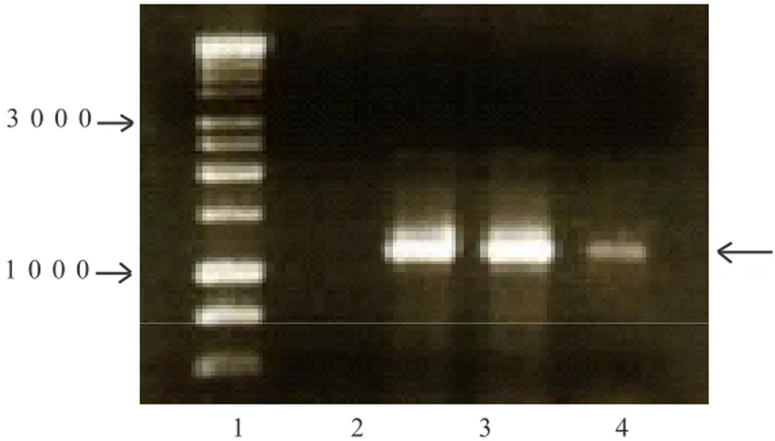 Gambar 5.   Elektroforesis gel agarose DNA patogen CVPD yang diamplifikasi dengan primer spesifik  OI1 dan  OI2c dari vektor CVPD