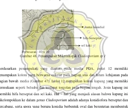Gambar 47. Penampakan Koloni Cladosporium sp 1 pada Media PDA : a. Bagian Atas; b. Bagian Bawah 