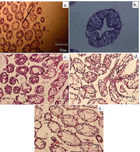 Gambar 1.  Gambaran  histologi  hepatopankreas  kepiting  bakau  (S.  serata)  setelah  akhir  perlakuan  pemaparan  konsentrasi  sublethal  fenol