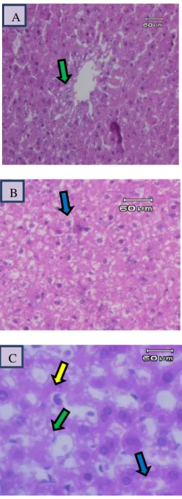 Gambar  2.  Gambaran mikroskopik hati tikus  kelompok B (perlakuan 1). Tampak gambaran  hati tidak normal dengan adanya perlemakan  hati (panah hijau), sinusoid berisi eritrosit  (panah biru) dan nekrosis sel (panah kuning)