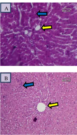 Gambar 4.  Gambaran mikroskopik hati tikus  kelompok D (perlakuan 3). Tampak gambaran  sel hati yang mengalami regenerasi pada  hampir seluruh bagian jaringan (panah biru),  hampir tidak ditemukan nekrosis pada sel dan  tampak vena sentralis (panah kuning)