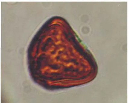 Gambar 7. Spora Pterris multifida               Gambar 8. Spora Pterris tripartite 