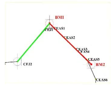 Gambar 4. 6. garis antara BM 1 - CEJ2 ( warna hijau)  5.  Ukur sudut antara garis BM 1 – BM 2 dengan garis BM 1 