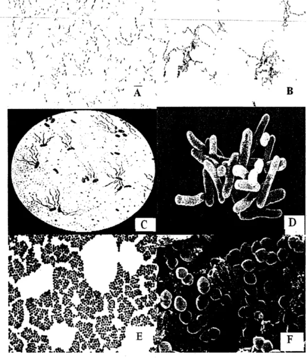 Gambar foto  1.2  Beberapa bakteria patogen (Anon, 2000) 