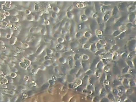 Gambar 3. Morfologi sel yang hidup pada kontrol sel SiHa dilihat dengan perbesaran 100x 