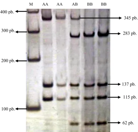 Gambar 2. Pola Pita Gen Pit-1 domba dalam Gel Poliakrilamida 6% dengan enzim Restriksi HinfI