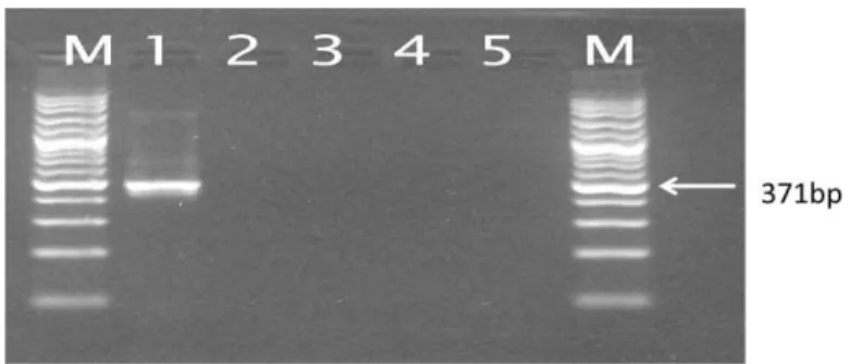 Gambar 2. Spesifisitas nested RT-PCR BRSV 