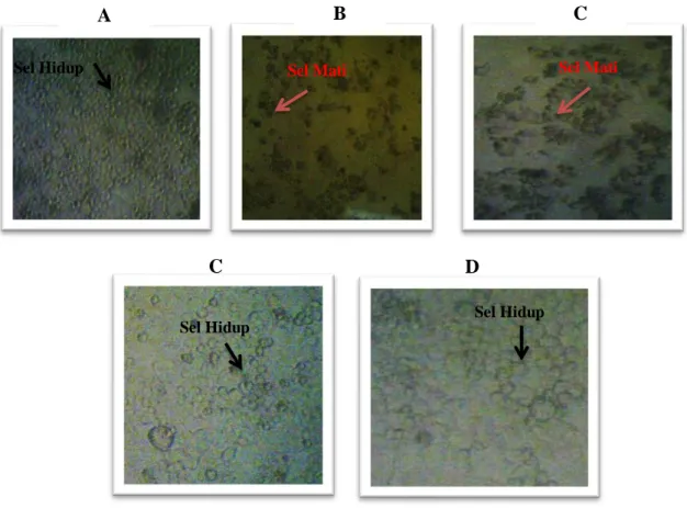Gambar 2 Morfologi sel WiDr, Kontrol sel WiDr(a), sel WiDr setelah pemberian ekstrak etanol  daun beluntas dengan konsentrasi 500µg/mL (b), sel WiDr setelah pemberian ekstrak etanol akar 