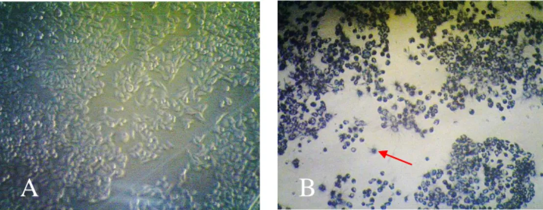 Gambar 3. Morfologi sel kanker T47D. (A) Sebelum mendapat perlakuan (B) Setelah mendapat  perlakuan doksorubisin 25 µg/mL