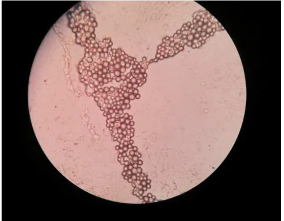 Gambar 4.2 Gambar koloni jamur Candida albicans.