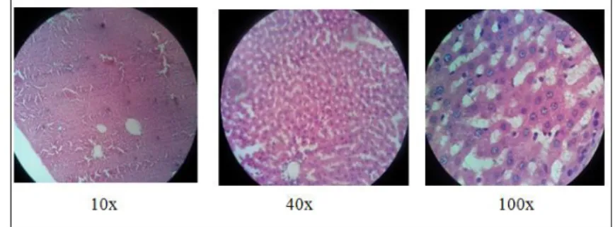 Gambar 2. Gambaran histopatologis salah satu tikus putih pada kelompok 2 (kelompok patologis) 
