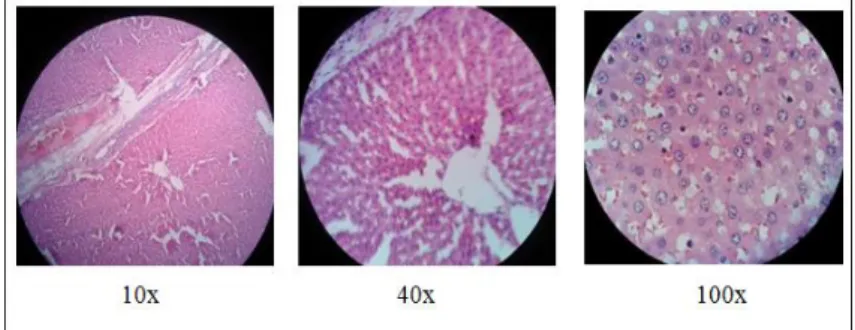 Gambar 5. Gambaran histopatologis tikus putih pada kelompok 5 