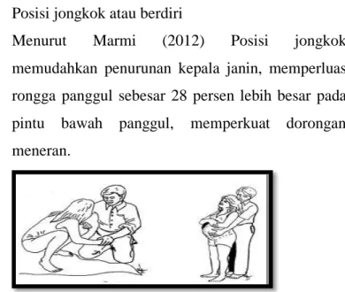Gambar  1.  Posisi  jongkok  atau  berdiriMenurut  Erawati (2011) . 