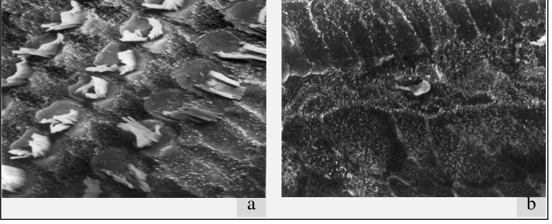 Gambar 2.2. dikutip dari (Alberti, W.P., 2006) a. Perubahan stereocilia pada marmut, pembesaran 1700X Mik
