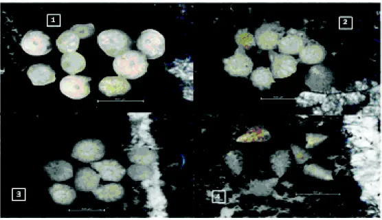 Gambar  10.  Foraminifera  bentik  yang dominan di lokasi penelitian: 1) Amphistegina, 2) Calcarina,    3) Streblus, 4) Reusella.
