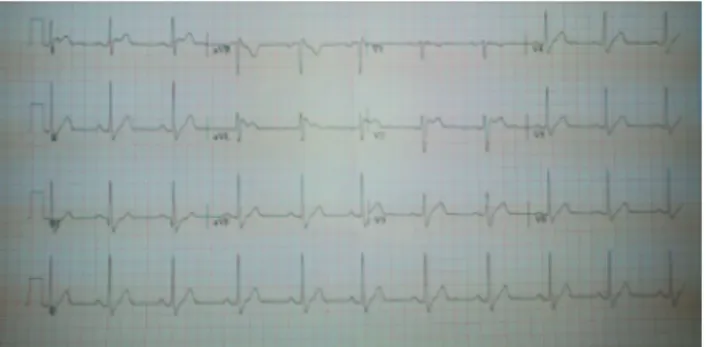 Gambar 4. EKG 27.03.2014Gambar 3. EKG 19.03.2013