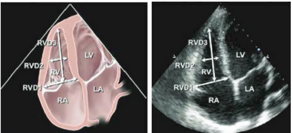 Gambar 4. Pengukuran dimensi ventrikel kanan dengan menggunakan ekokardiografi  transtorakal berdasarkan Guidelines for the Echocardiographic Assessment of Right  Heart in adults: A report from the American Society of Echocardiography 2010