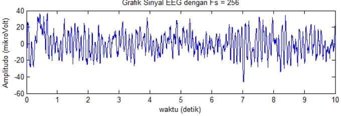 Gambar IV.2. Sinyal EEG (raw signal) 