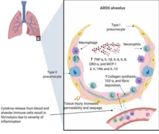 Gambar  4.  Peran  sitokin  terhadap  kerusakan  vaskuler  dan  perdarahan  pada  paru(McGonagle, O’Donnell, et al., 2020)