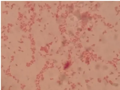 Gambar 1. Bakteri Gram Negatif berbentuk Coccus