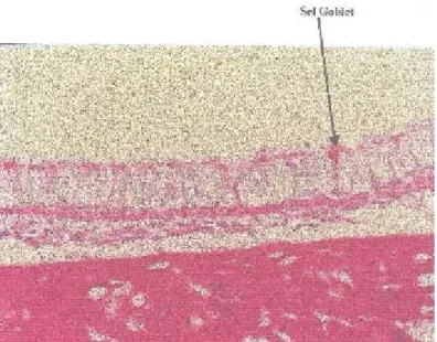 Gambar 3. Hiperplasi sel goblet trakea pada tikus kelompok II (dipajan asap rokok saja)
