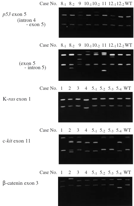 Fig. 2.“Cold” SSCP analysis of p53, K-ras, c-kit, and β-cate-nin genes in the tissues of the adrenal lymphoma and metastaticlesions from selected cases