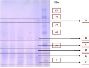 Gambar  6.  Pola  pita  protein  daun  tanaman  melinjo pada berbagai perlakuan konsentrasi NaCl  yang berbeda dengan SDS-PAGE